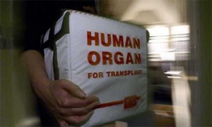 organ transplant